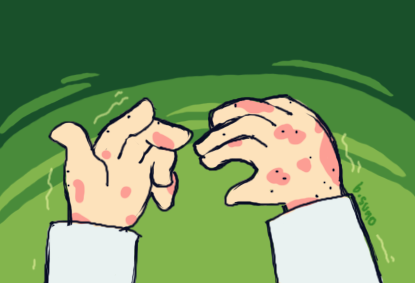 Image: Mia's hands, shaking and covered in rashes.